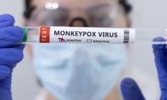 Phát hiện ca nghi lây nhiễm virus gây bệnh đậu mùa khỉ từ người sang chó đầu tiên