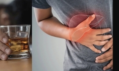 Nên làm gì để giảm tác hại của rượu bia đến gan?