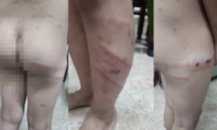 Bất ngờ lời khai của người mẹ cùng người tình bạo hành con trai 11 tuổi