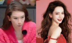 Mặt biến dạng do tiêm botox, mỹ nhân nổi tiếng bộc bạch: Đến tôi còn hết hồn, kinh hãi!