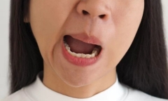 Đừng làm ngơ trước những dấu hiệu cảnh báo nguy cơ đột quỵ này vào buổi sáng kẻo hối tiếc không kịp