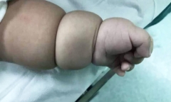 Con trai bụ bẫm, tay chân chia khúc như củ sen, mẹ chưa kip vui đã suýt ngất vì câu nói của bác sĩ