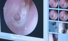 Cô gái bị bạn trai hôn cuồng nhiệt đến mức thủng màng nhĩ