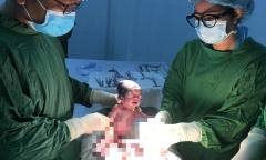 Tin tức đời sống ngày 23/7: Phẫu thuật thành công cho sản phụ mang 3 thai nhi tự nhiên