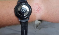 Tin tức công nghệ mới nóng nhất hôm nay 22/9: Bỏng tay vì đeo Samsung Galaxy Watch qua đêm