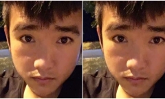 Bị 