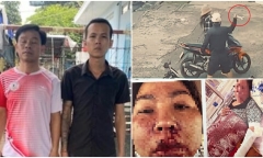 Bắt 2 đối tượng dùng cờ lê hành hung người phụ nữ trước cổng trường học: Nghi vấn mâu thuẫn từ món nợ 