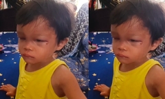 Làm rõ vụ bé gái 4 tuổi nghi bị cha nuôi đánh đập ở Cà Mau