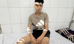Clip: Chi tiết lời khai của đối tượng lái xe 
