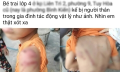 Công an vào cuộc vụ bé trai 10 tuổi nghi bị bạo hành ở Đắk Lắk