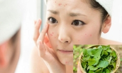 Rau diếp cá trị mụn: Sự thật hay chỉ là tin đồn?