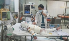 Tin tức đời sống ngày 29/12: Mẹ lóc toàn bộ da đùi ghép cho con trai bị bỏng 93% cơ thể