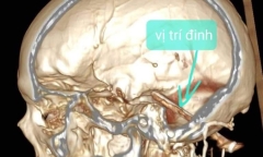 Thấy bất thường đi viện kiểm tra, bàng hoàng khi nhận kết quả