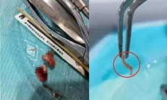 Tin tức đời sống ngày 12/2: Bác sĩ hoảng hồn khi thấy con vật ngoe nguẩy trong răng bệnh nhân