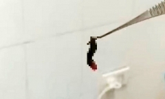 Tin tức đời sống ngày 29/10: Gắp con vắt dài hơn 2cm ra khỏi hốc mũi nữ bệnh nhân