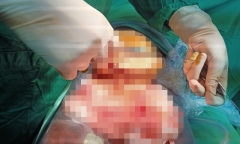 Vụ phạm nhân tự cắt