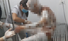 Vụ vợ tẩm xăng đốt chồng ở Vĩnh Phúc: Hé lộ nguyên nhân