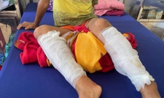 Vụ học sinh lớp 3 bị cha ruột trói, dùng xăng đốt chân: Hé lộ nguyên nhân