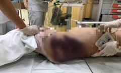 Vụ bé gái 8 tuổi nghi bị 