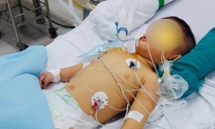 Bé trai 14 tháng tuổi tổn thương não vì gặp tai nạn thương tâm ngay tại nhà