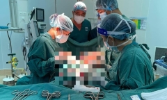 Tin tức đời sống ngày 22/10: Phẫu thuật lấy ra hơn 100 khối bướu xếp đầy ổ bụng bệnh nhân