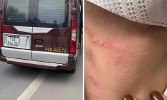 Vụ nhà xe bị tố hành hung, bỏ rơi khách giữa cao tốc: Chưa liên lạc được với nạn nhân