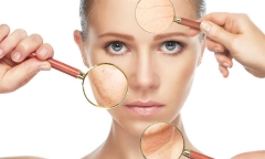 7 dấu hiệu thường gặp khi cơ thể mất collagen quá nhanh