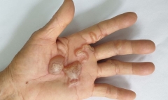 Cảnh báo nhiễm ký sinh trùng từ động vật nuôi trong nhà