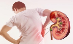 8 thói quen cần bỏ ngay nếu không muốn thận chứa cả “túi” sỏi