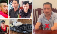 Tin tức đời sống ngày 18/7/2024: Cứu bé 7 tuổi chấn thương sọ não nguy kịch