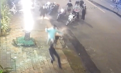 Vừa bước ra khỏi quán cà phê, nam thiếu niên 15 tuổi bị chém đứt lìa ngón tay