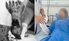 Kích hoạt báo động đỏ, cứu sống thanh niên bị sốc mất máu
