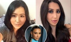 Người phụ nữ chi 60.000 USD, trải qua 15 cuộc phẫu thuật để giống Kim Kardashian 