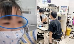 Số ca mắc gia tăng, nguy cơ bùng dịch đau mắt đỏ ở TP.HCM