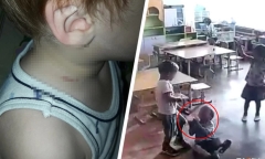 Con đi học về có vết thâm tím trên cổ, mẹ phát hiện chuyện kinh hoàng khi xem camera