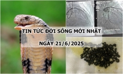 Tin tức đời sống 21/6: Gần 400 viên sỏi nằm dày đặc bên trong túi mật của người phụ nữ