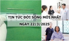 Tin tức đời sống 22/3: Vô tình nuốt kim dài 5cm khi đang khâu quần áo
