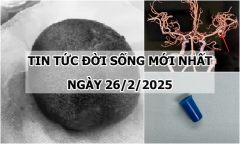 Tin tức đời sống 26/2: Đau tức vùng bụng dưới, đi khám phát hiện điều gây choáng