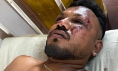 Thảm kịch rơi máy bay ở Ấn Độ, 260 người thiệt mạng: Nam hành khách sống sót duy nhất vật lộn với chấn thương tâm lý