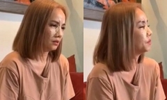 Nóng: Cận cảnh gương mặt băng bó chằng chịt của 