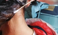 Gáy con gái bỗng xuất hiện đốm đen, mẹ tưởng nốt ruồi mới mọc, nghe bác sĩ nói liền sợ tái mặt