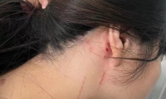 Cô gái 34 tuổi gặp chuyện đáng sợ chỉ vì từ chối đi xem mắt