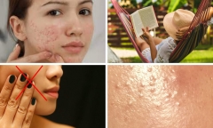 Bỏ ngay những thói quen này nếu không muốn mụn ẩn mọc mãi trên mặt