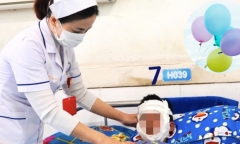 Dùng bật lửa chơi cùng bóng bay hình ông già Noel, bé trai 4 tuổi bị bỏng mặt