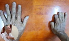 Vụ thảm án 6 người bên bờ biển Quảng Ngãi (Kỳ 4): Bàn tay cụt nhiều ngón 