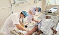 Giữ thang giúp hàng xóm, người đàn ông bị bỏng nặng toàn thân