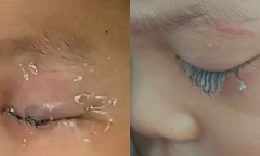 Thấy bố hay nhỏ thuốc đau mắt, cậu bé tò mò bắt chước làm theo nhưng lại bằng “keo 502”