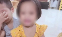 Vụ bé 3 tuổi bị găm 9 đinh vào đầu: Diễn biến sức khỏe mới nhất của bé