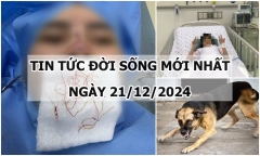 Tin tức đời sống 21/12: Cô gái bị biến dạng mũi sau khi căng chỉ nâng mũi