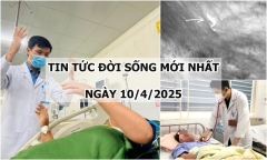 Tin tức đời sống 10/4: Hy hữu người phụ nữ bị heo tấn công, gãy 11 xương sườn